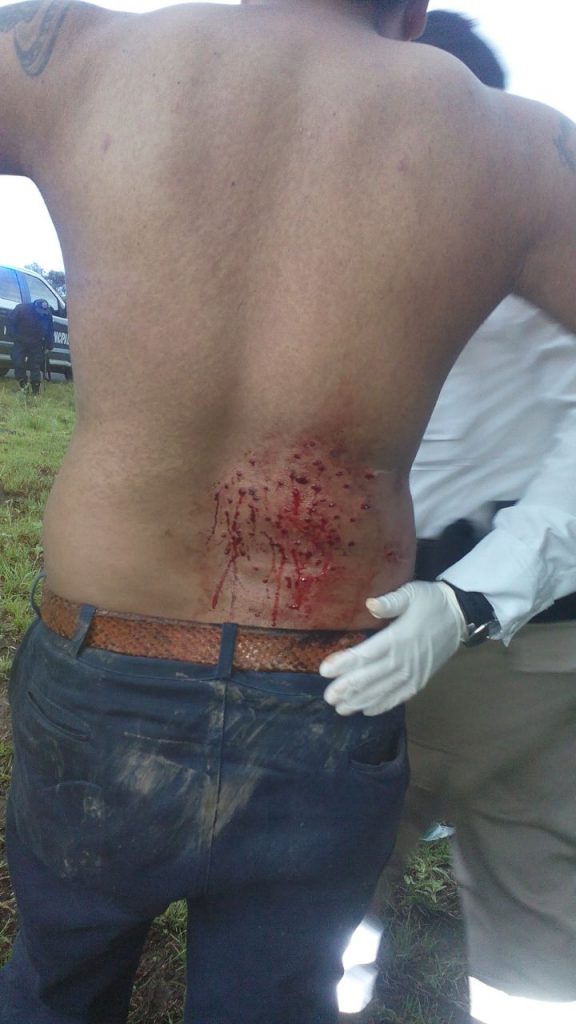 «Venadearon» a un hombre: está herido