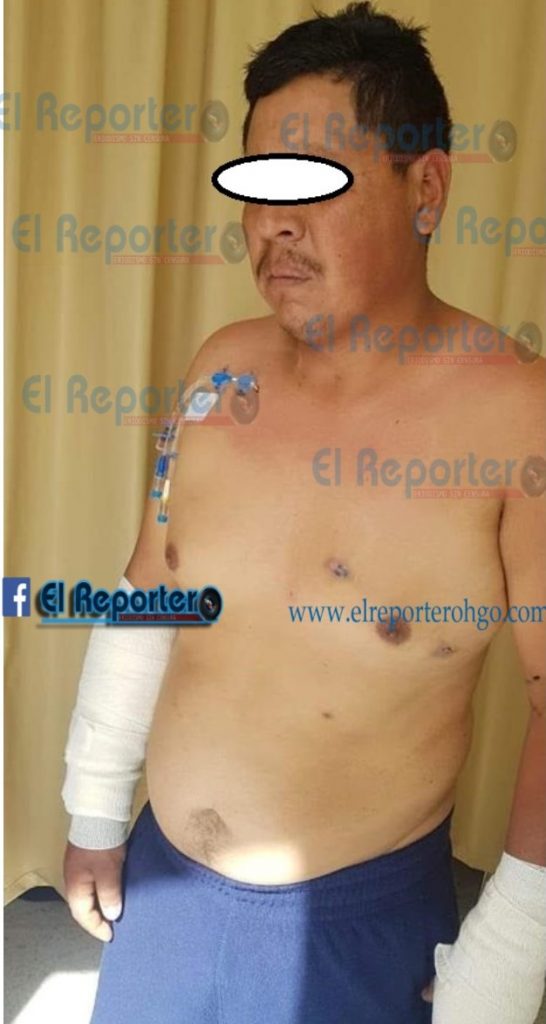 Asesinaron a un hombre de trabajo