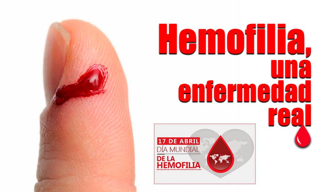 Importante detección oportuna de la hemofilia