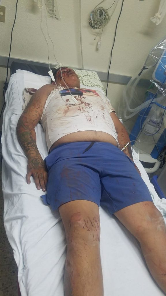 Tres muertos y siete heridos en balneario de El Tephé