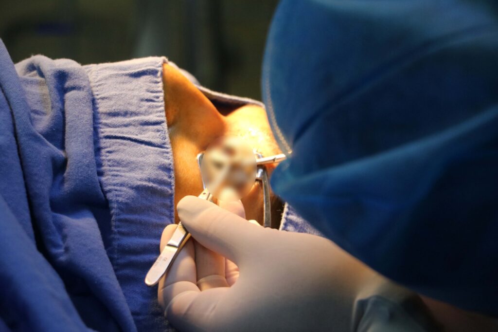 Mejoran la calidad de la visión de dos hidalguenses.