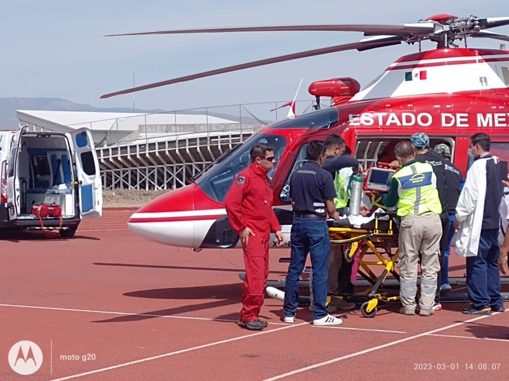 Chiquilla con quemaduras fue trasladada al hospital de Galveston