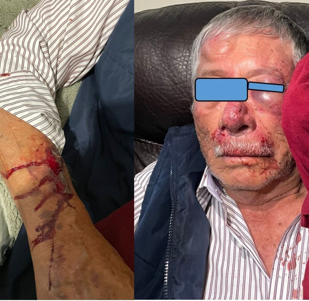 Vándalos casi matan a un adulto mayor